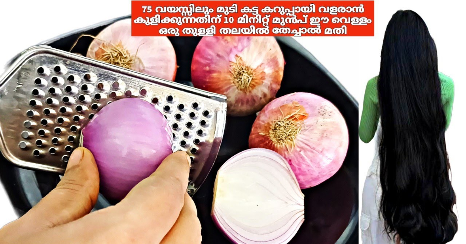 Onion Juice For Hair Growth And And Dandruff Relief