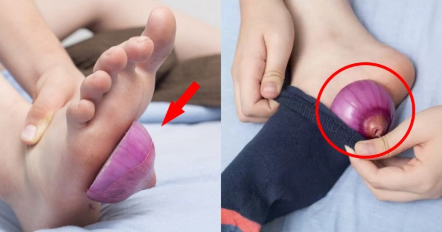 Sleep With Onion On Feet Benefits