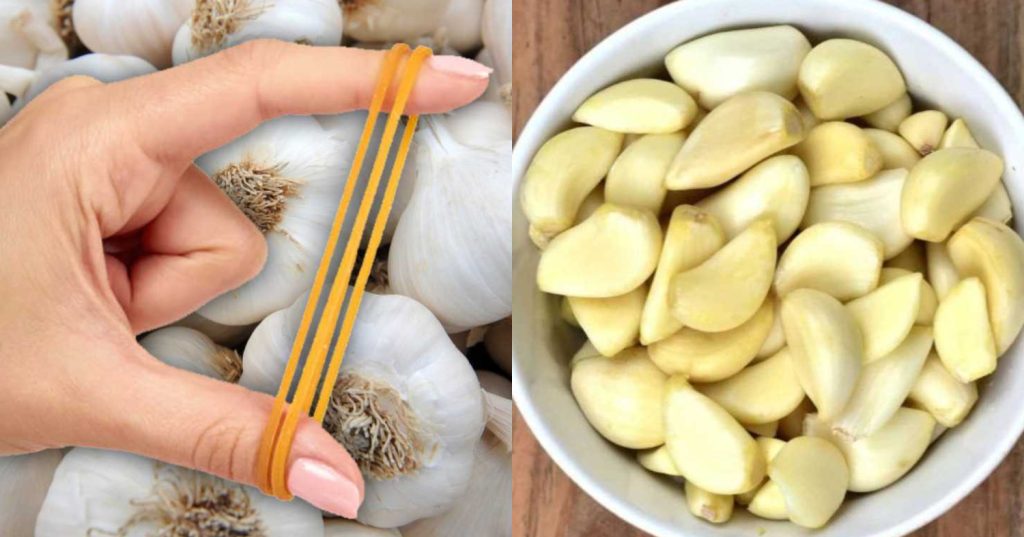 Garlic Peeling Easy Tip Using Rubber Band | ഒരു റബർബാൻഡ്‌ മതി; എത്ര ...