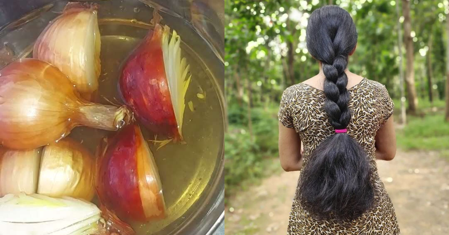 Faster Hair Growth Remedy Using Onion