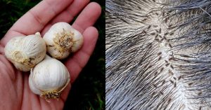 Lice And Eggs Removal Tip