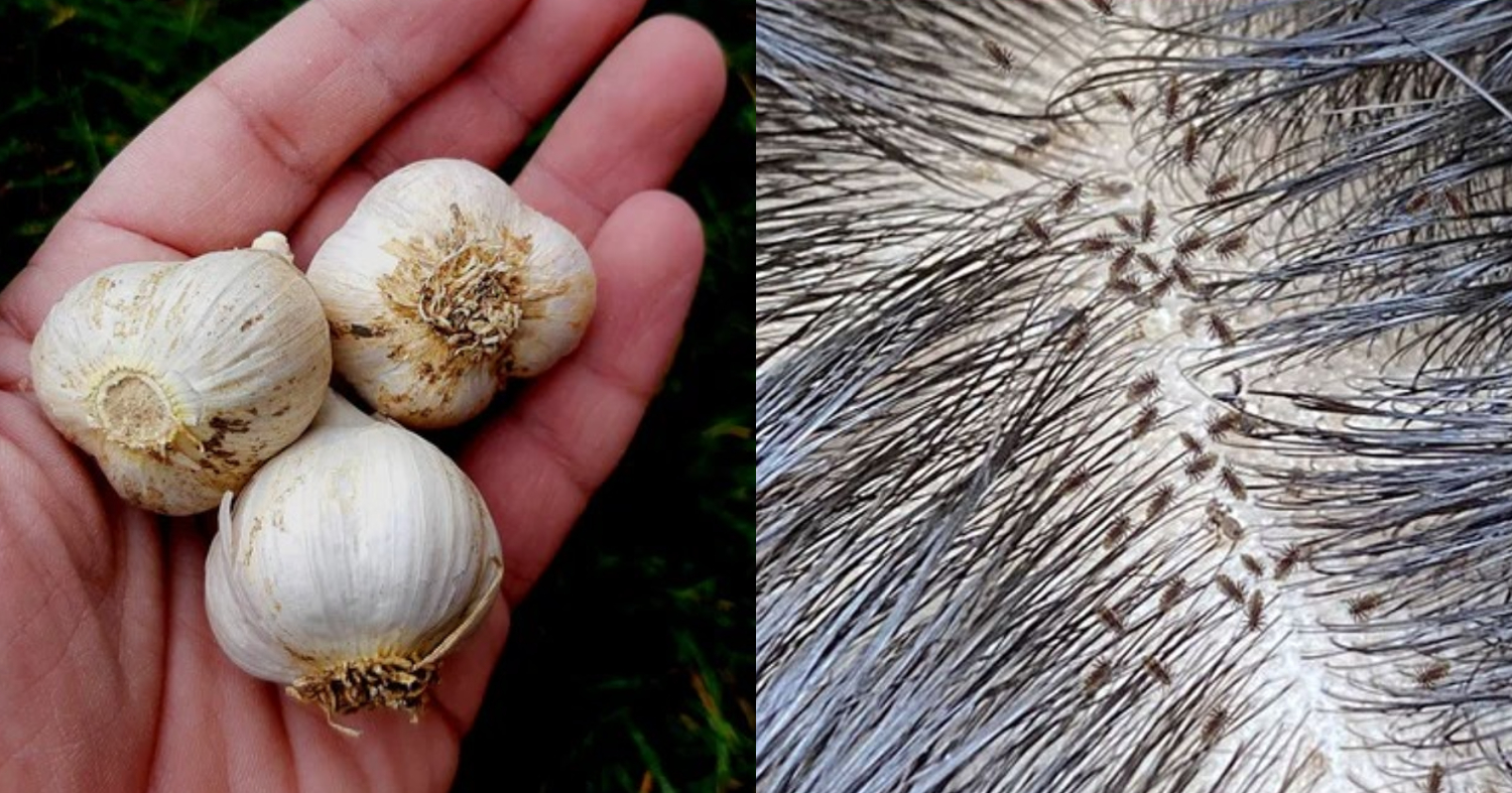 Lice And Eggs Removal Tip