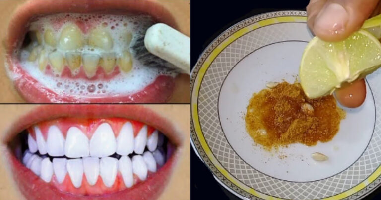 Teeth Whitening Home Remedy