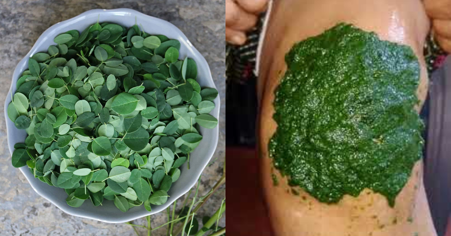 Natural Home Remedy For Knee Pain