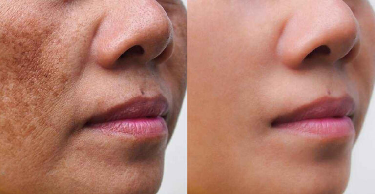 Best Skin Care Routine