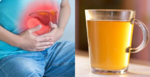 Fatty Liver Treatment