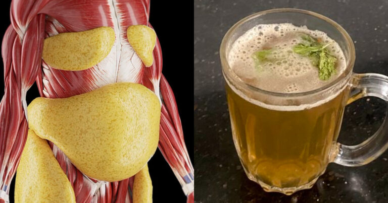 Weight Loss Treatment Using Passion Fruit Leaf