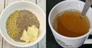 Weight loss Treatment