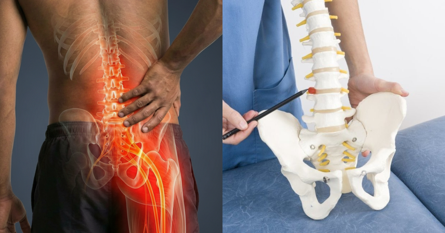 Disc Pain Treatment